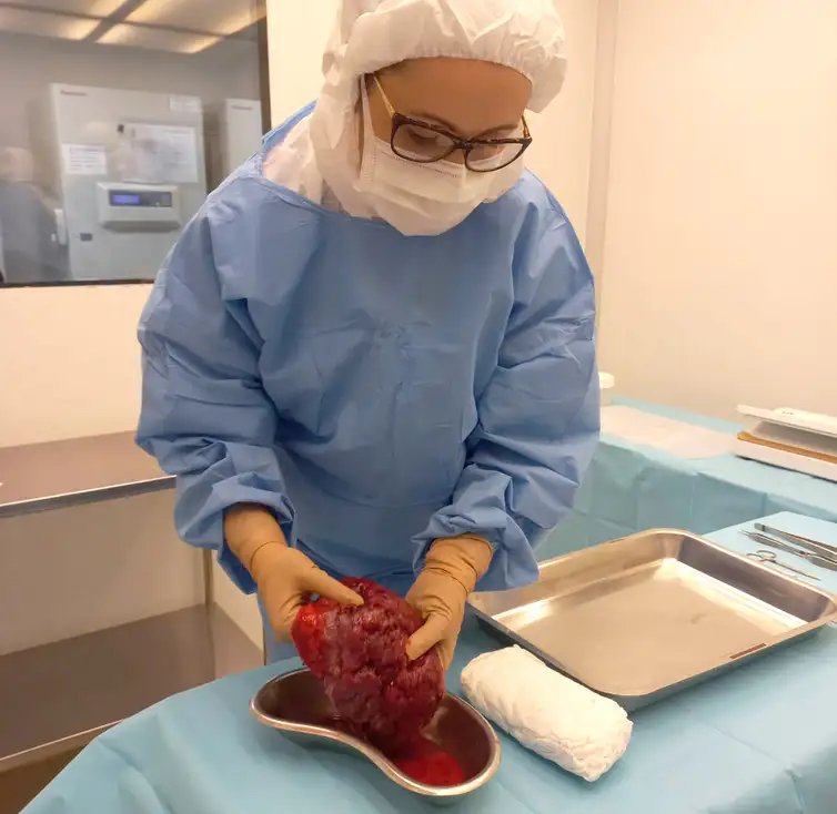 INTO/Divulgação Rio de Janeiro (RJ) - Curativo biológico à base de placenta, desenvolvido pelo Instituto Nacional de Traumatologia e Ortopedia-INTO. Foto: INTO/Divulgação